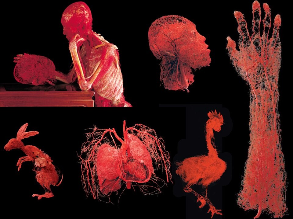 Wystawa BODY WORLDS powraca do Katowic z now&#261; ekspozycj&#261;!